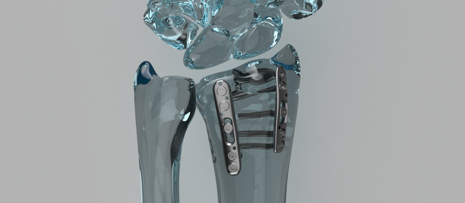 Advanced Plate Design